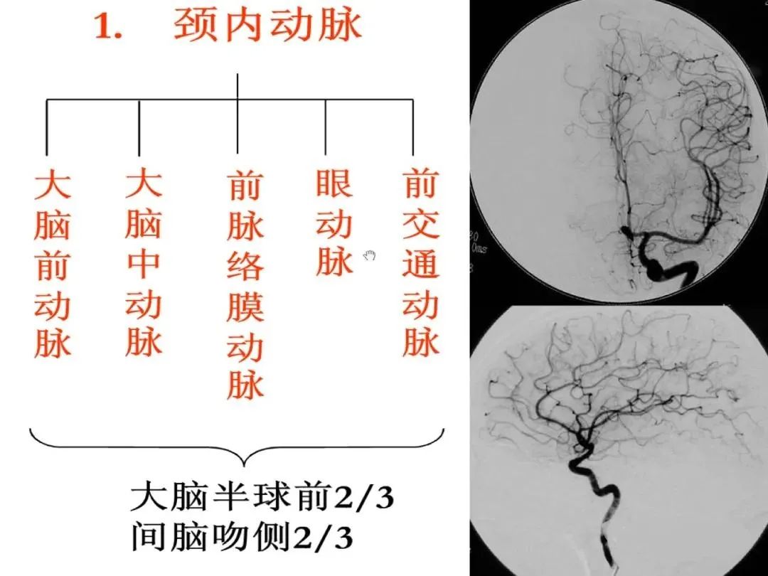 从梗死部位推测责任血管：脑血管解剖-3