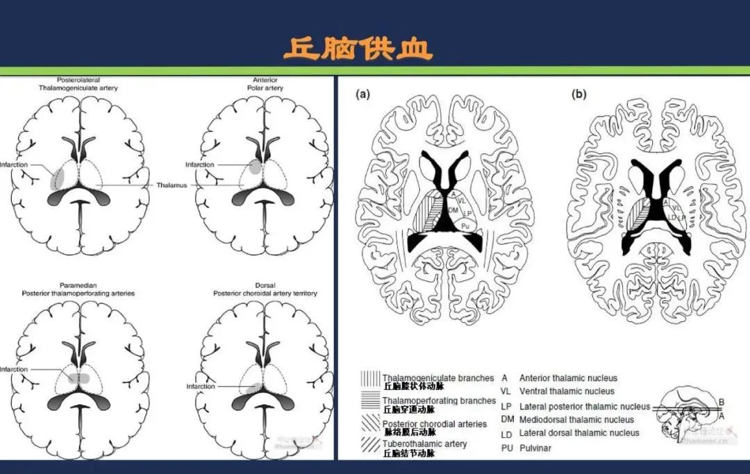 从梗死部位推测责任血管：脑血管解剖-100