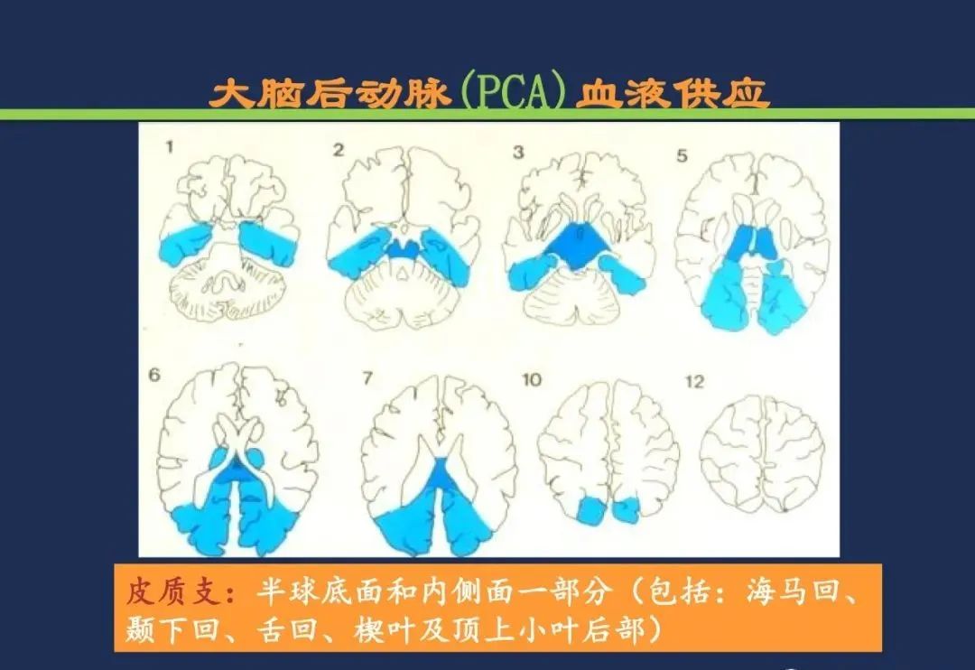 从梗死部位推测责任血管：脑血管解剖-88