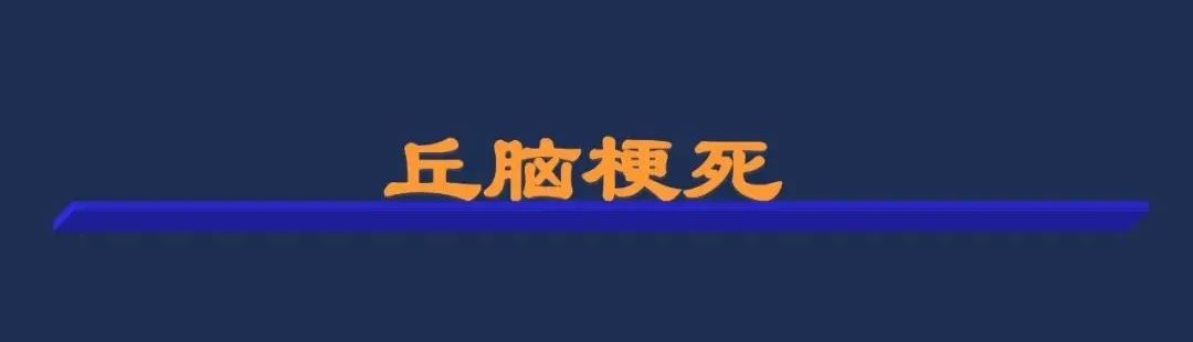 从梗死部位推测责任血管：脑血管解剖-97