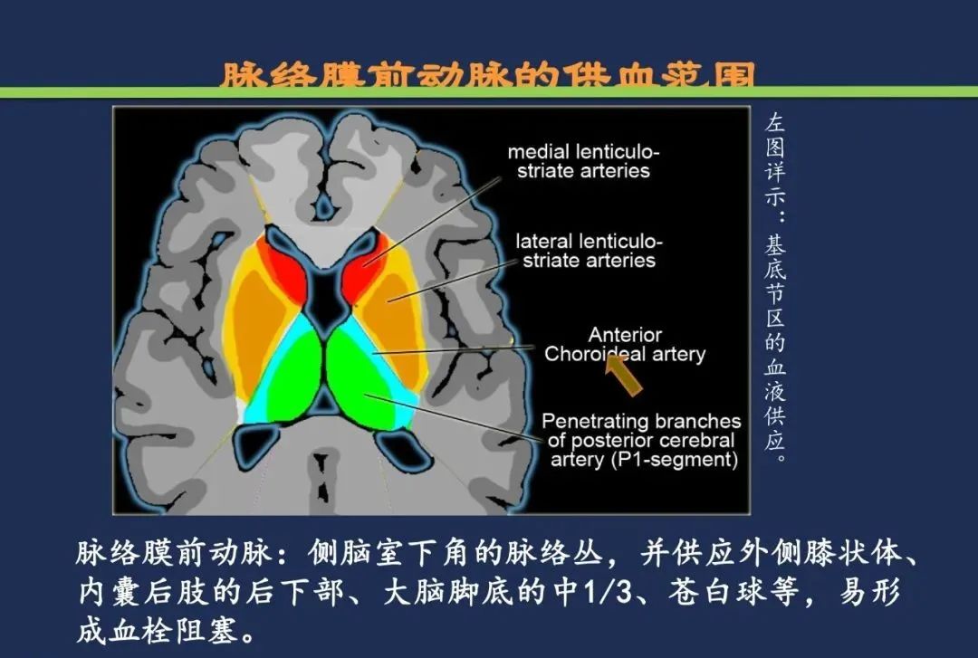 从梗死部位推测责任血管：脑血管解剖-77