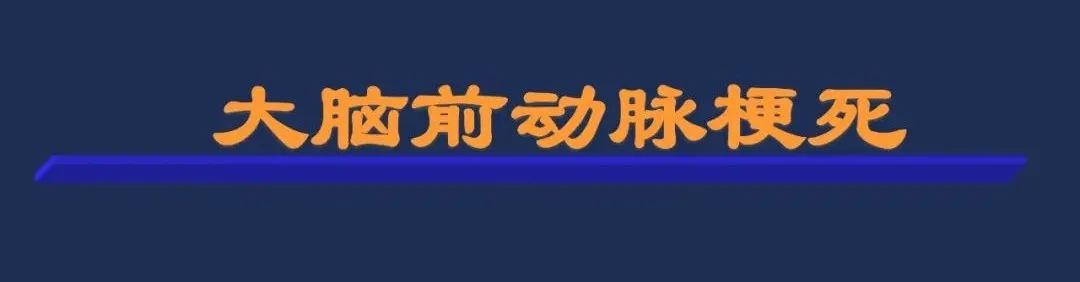 从梗死部位推测责任血管：脑血管解剖-54