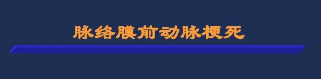 从梗死部位推测责任血管：脑血管解剖-74