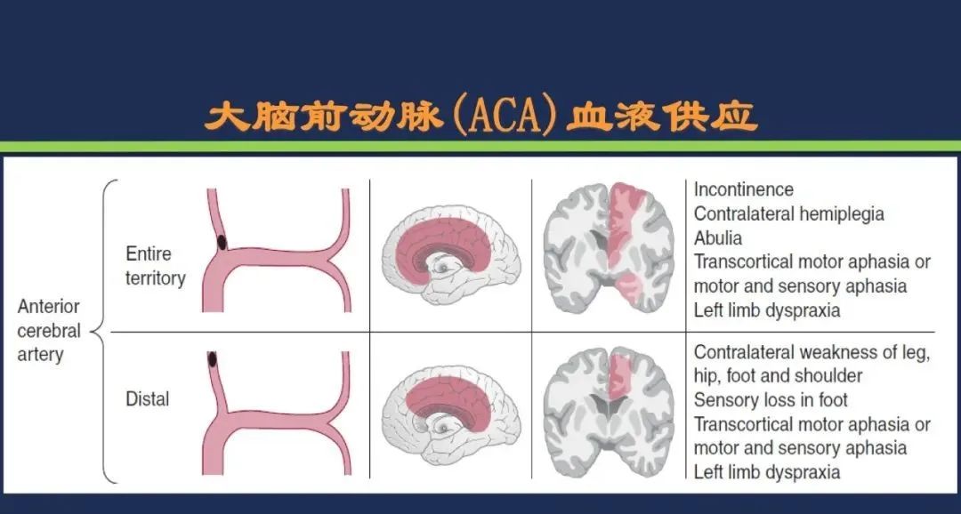从梗死部位推测责任血管：脑血管解剖-57