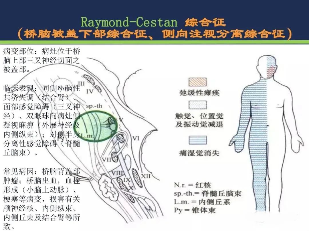 从梗死部位推测责任血管：脑血管解剖-142