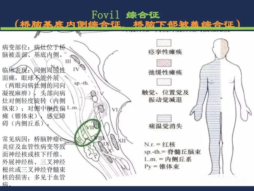 从梗死部位推测责任血管：脑血管解剖-132