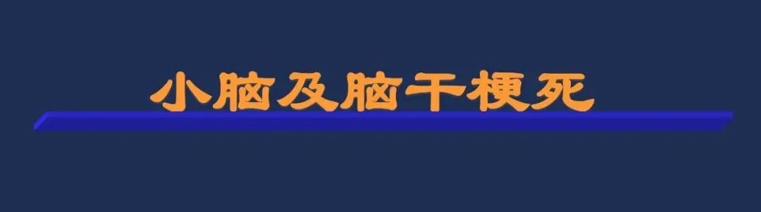 从梗死部位推测责任血管：脑血管解剖-123