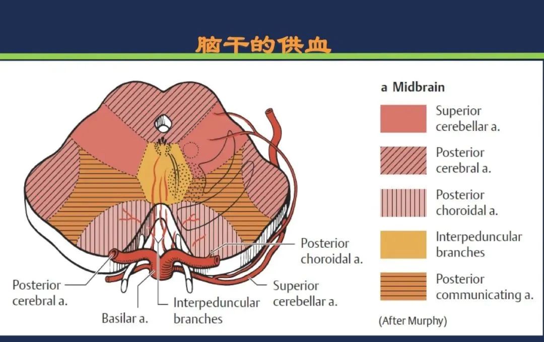 从梗死部位推测责任血管：脑血管解剖-129