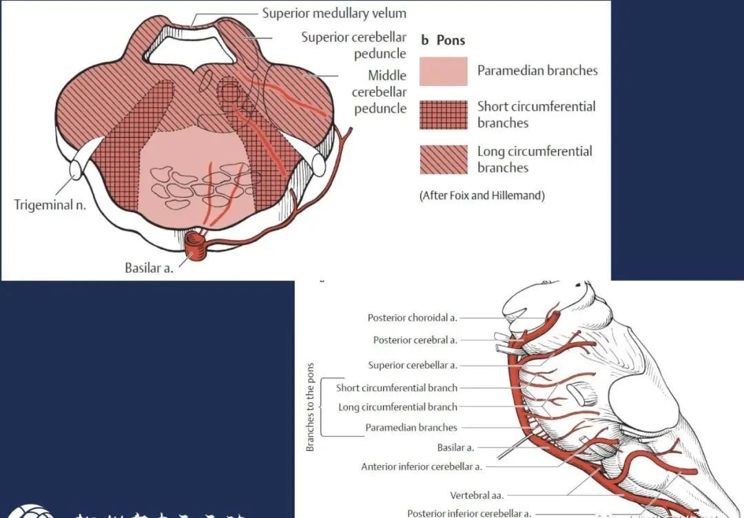 从梗死部位推测责任血管：脑血管解剖-130