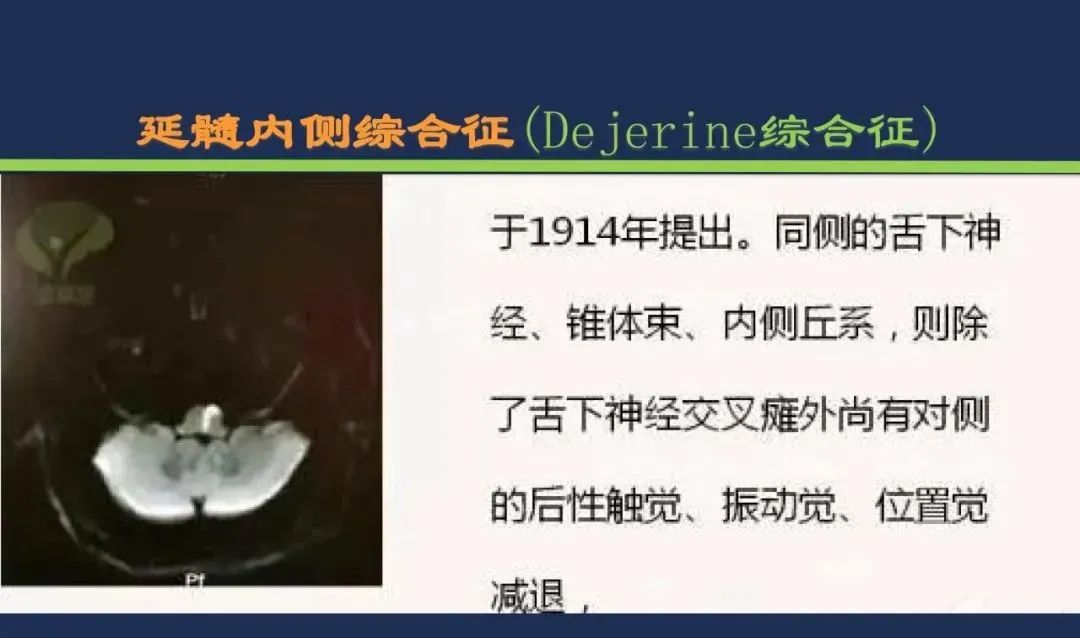 从梗死部位推测责任血管：脑血管解剖-187