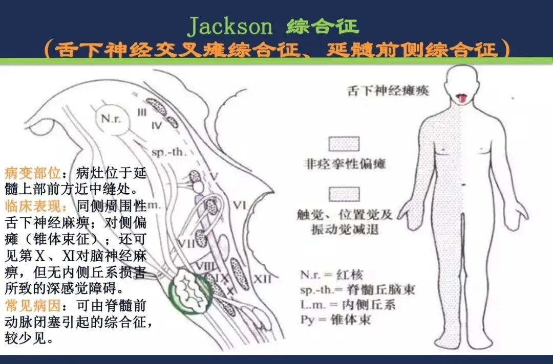 从梗死部位推测责任血管：脑血管解剖-189