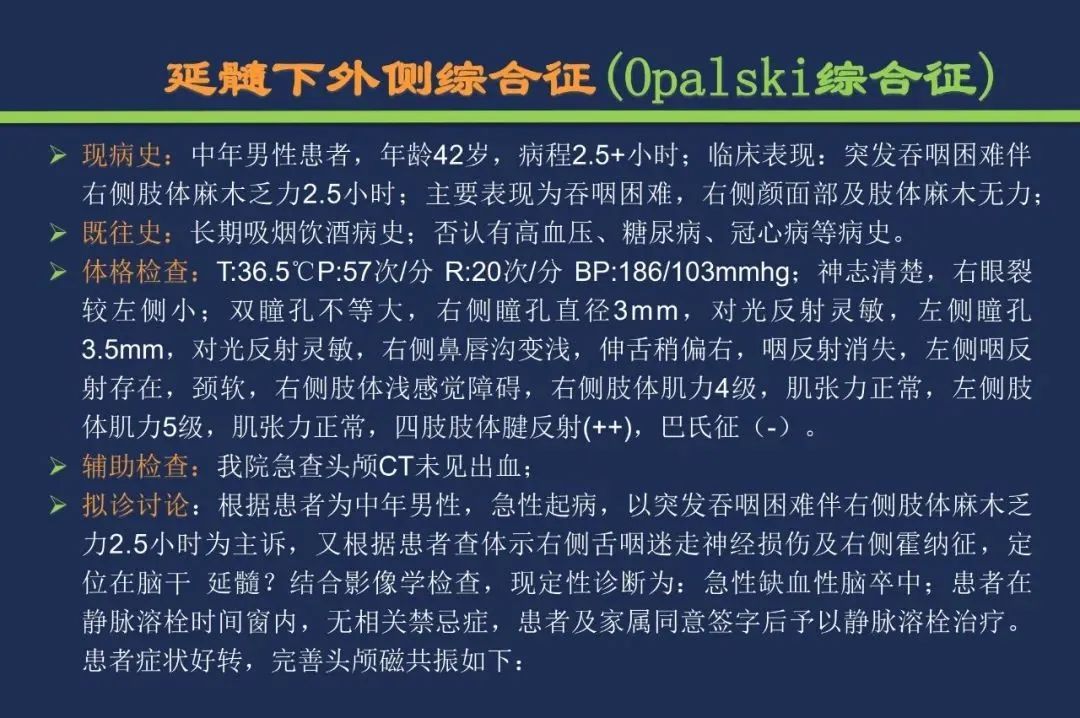 从梗死部位推测责任血管：脑血管解剖-178