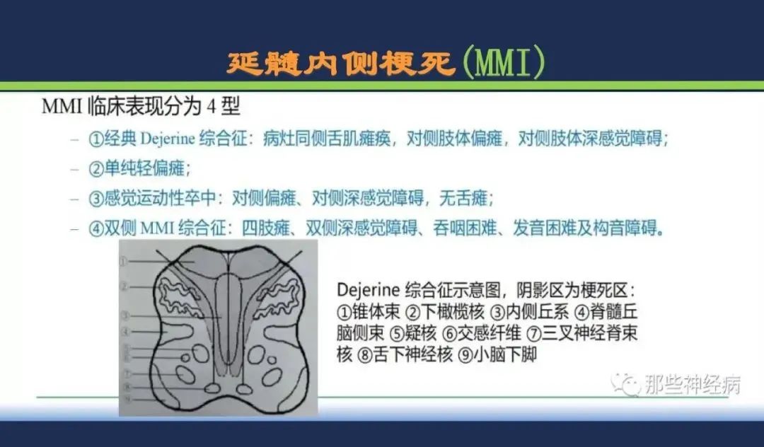 从梗死部位推测责任血管：脑血管解剖-185