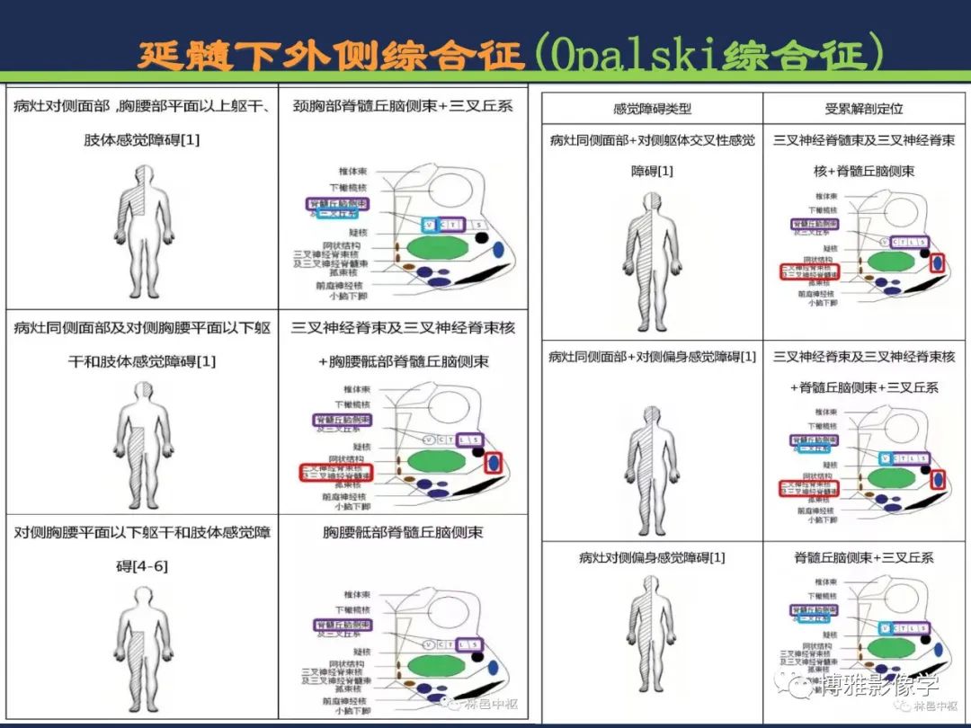 从梗死部位推测责任血管：脑血管解剖-180