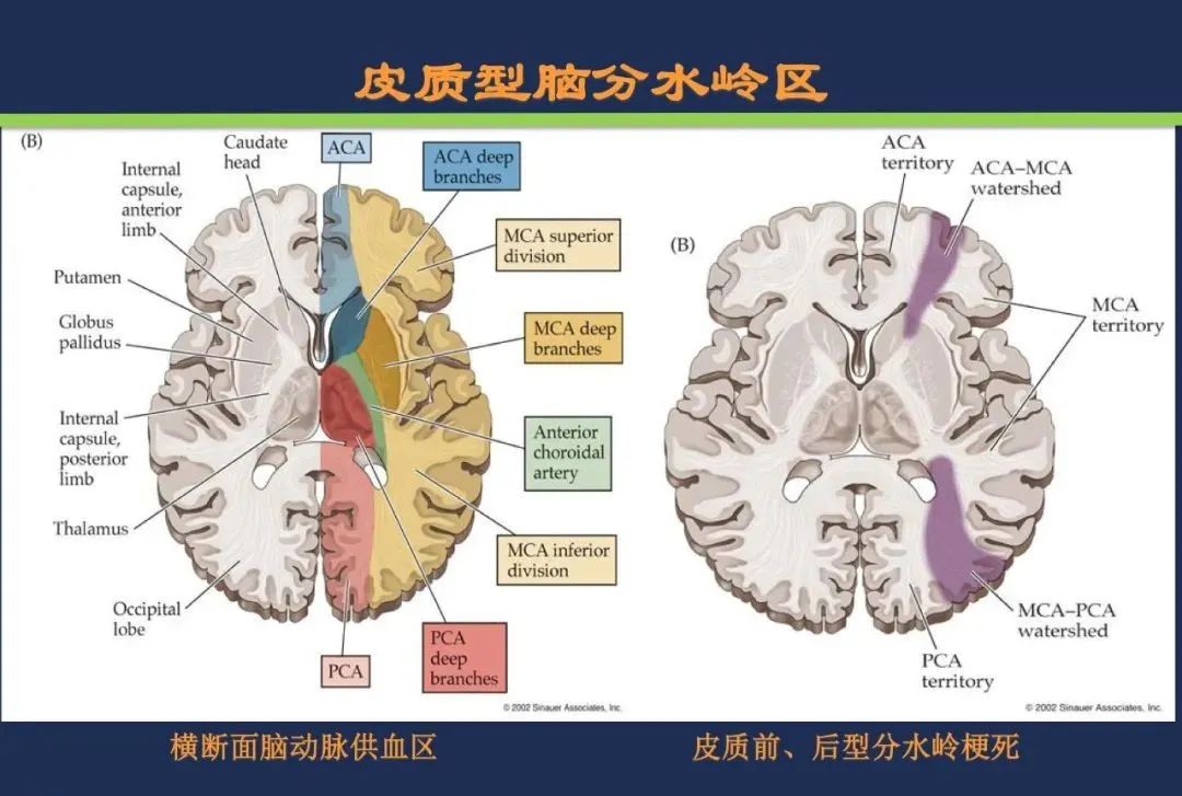 从梗死部位推测责任血管：脑血管解剖-239
