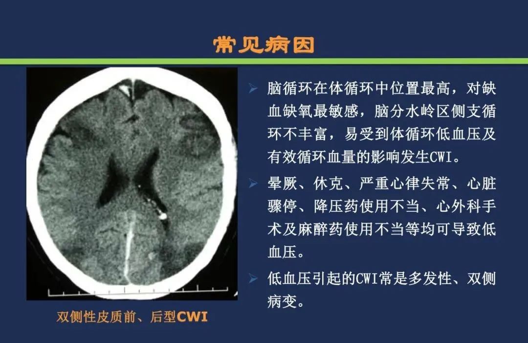 从梗死部位推测责任血管：脑血管解剖-220