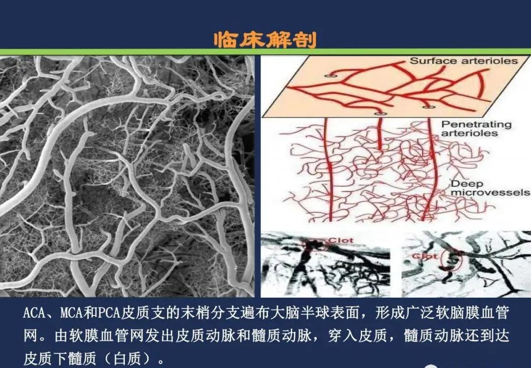从梗死部位推测责任血管：脑血管解剖-217