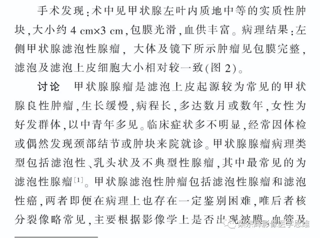 【病例】甲状腺腺瘤1例影像诊断思维-5