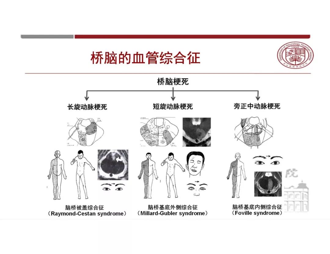 【PPT】脑血管的解剖基础-36