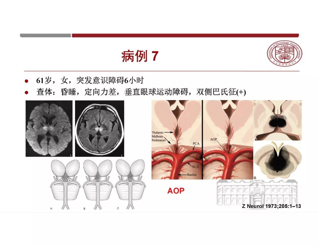 【PPT】脑血管的解剖基础-26
