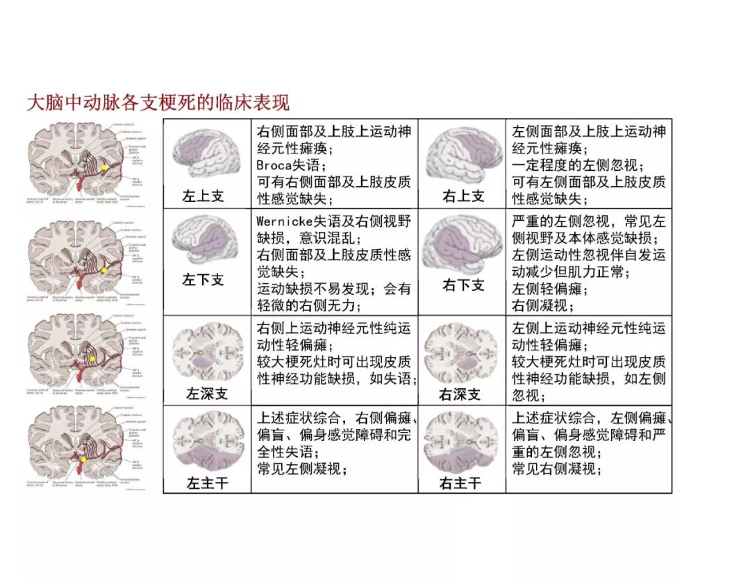 【PPT】脑血管的解剖基础-22