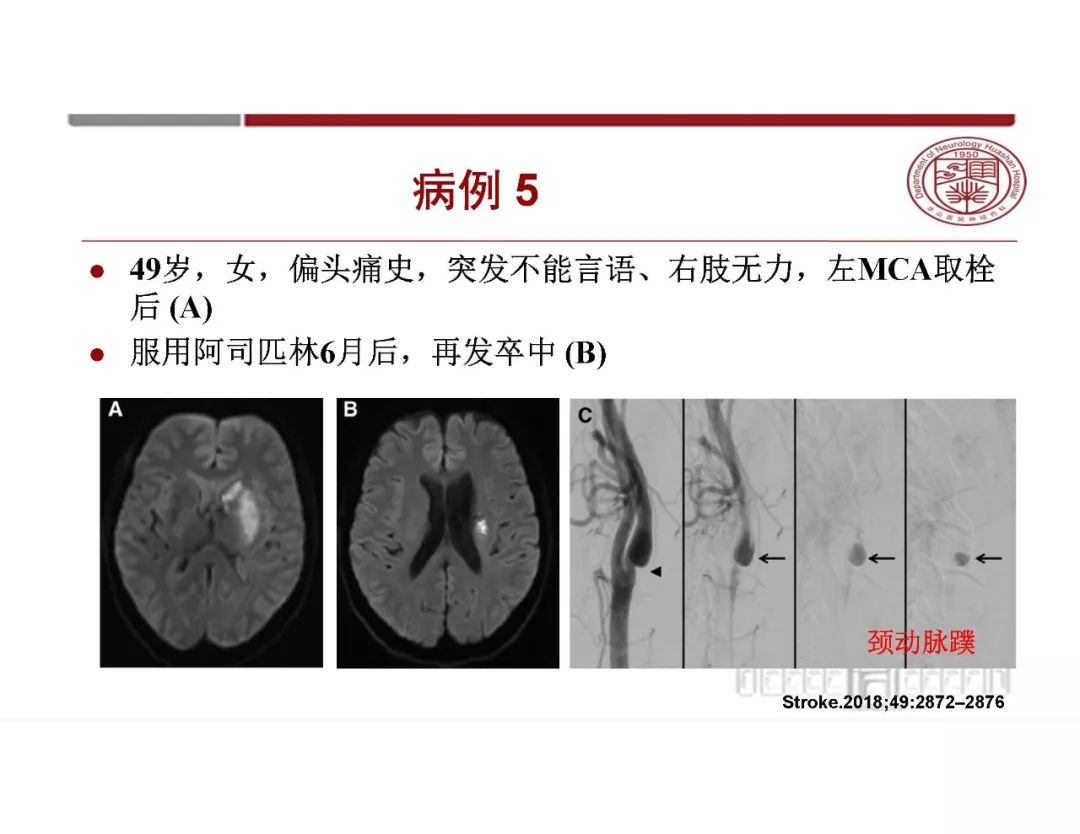 【PPT】脑血管的解剖基础-13