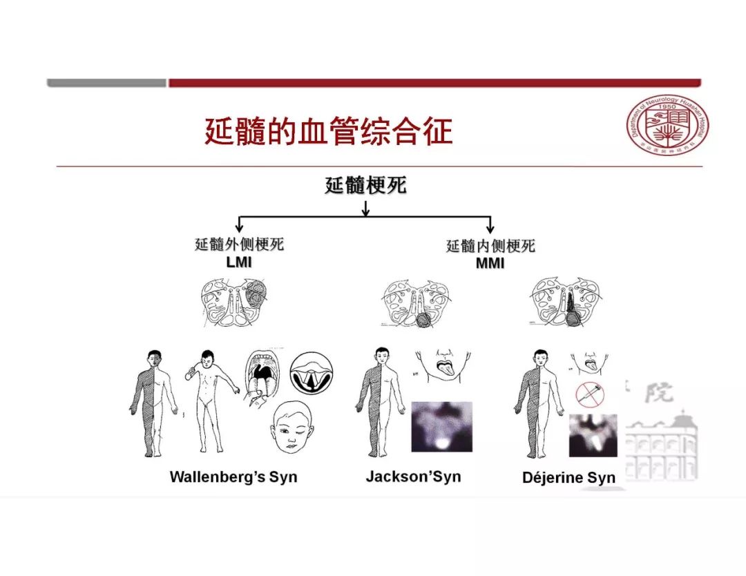 【PPT】脑血管的解剖基础-32
