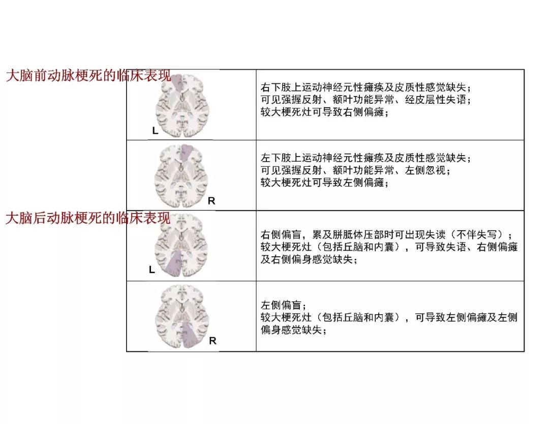 【PPT】脑血管的解剖基础-23