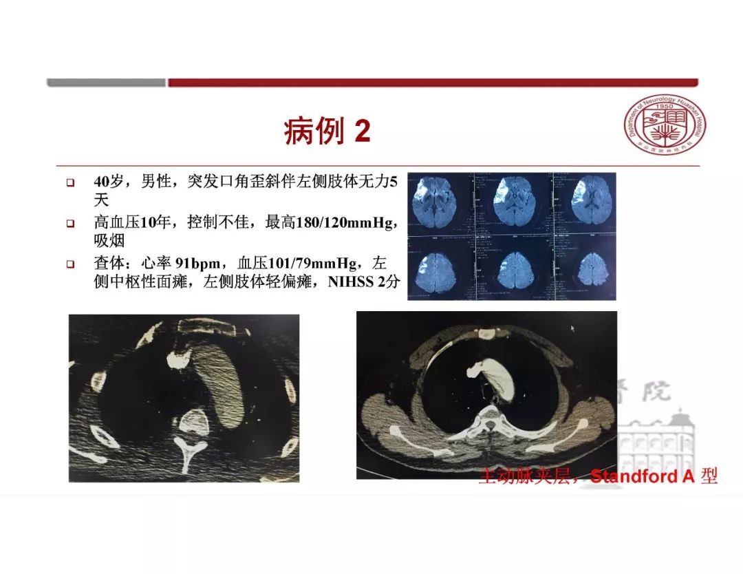 【PPT】脑血管的解剖基础-7