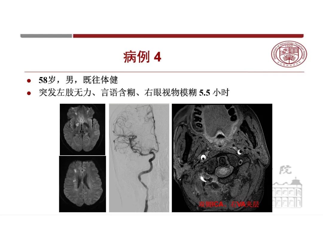 【PPT】脑血管的解剖基础-12