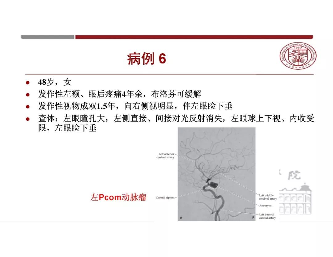 【PPT】脑血管的解剖基础-14