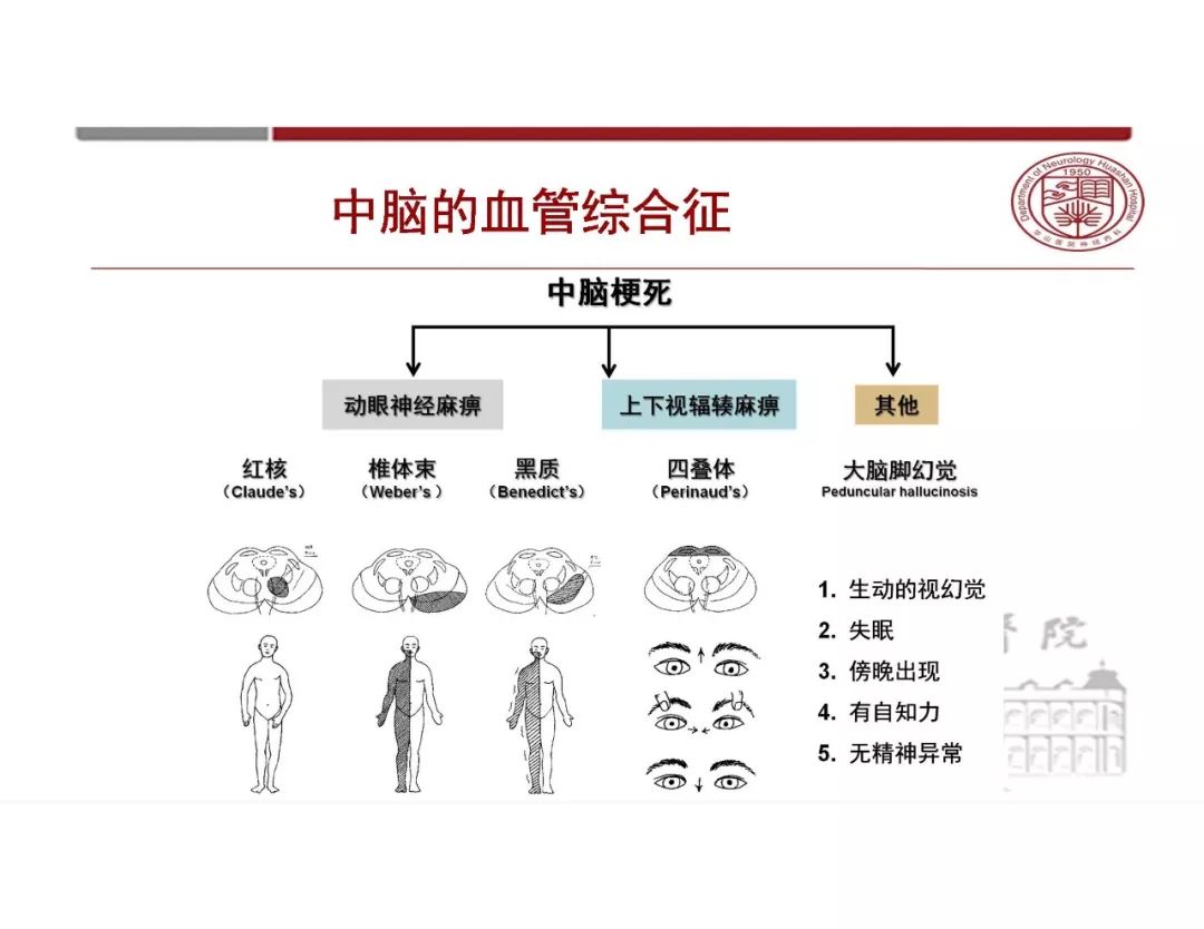【PPT】脑血管的解剖基础-38