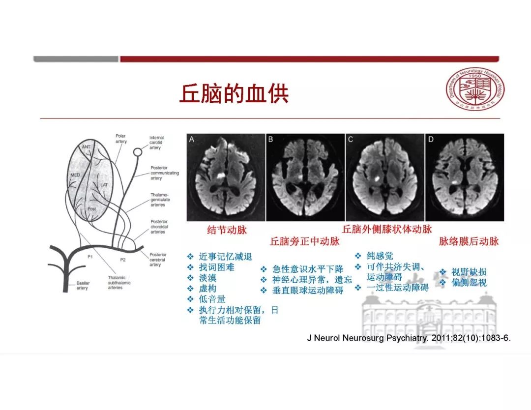 【PPT】脑血管的解剖基础-25