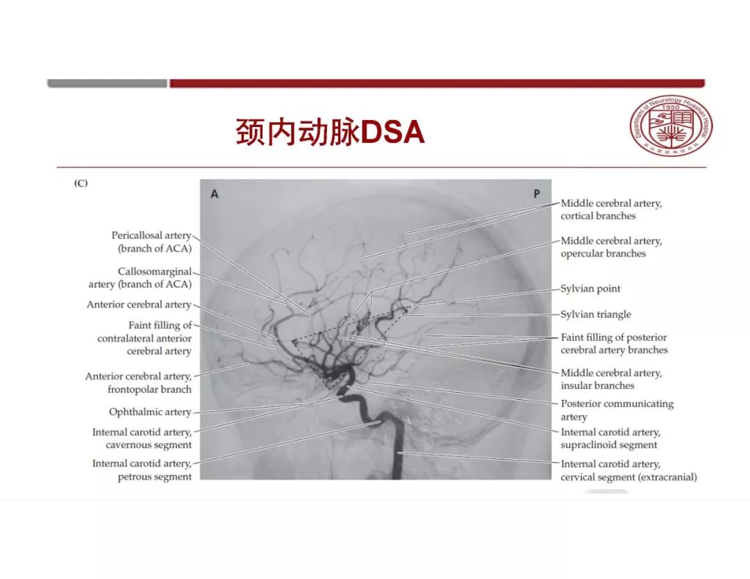 【PPT】脑血管的解剖基础-9