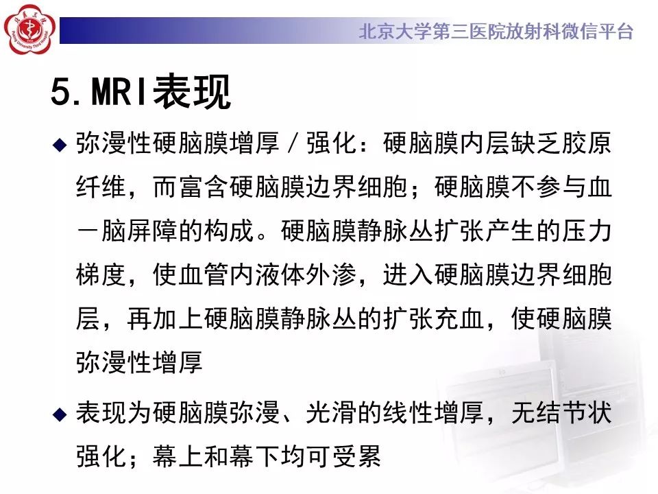 【PPT】低颅压综合征的MR影像