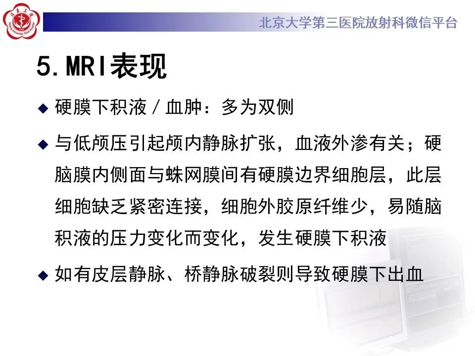 【PPT】低颅压综合征的MR影像