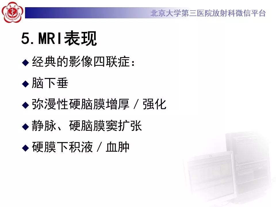 【PPT】低颅压综合征的MR影像