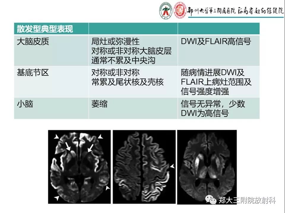 【PPT】常见弥漫性脑皮层病变