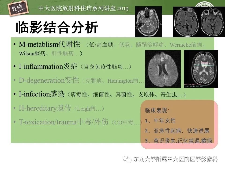 【PPT】自身免疫性脑炎影像表现及诊断