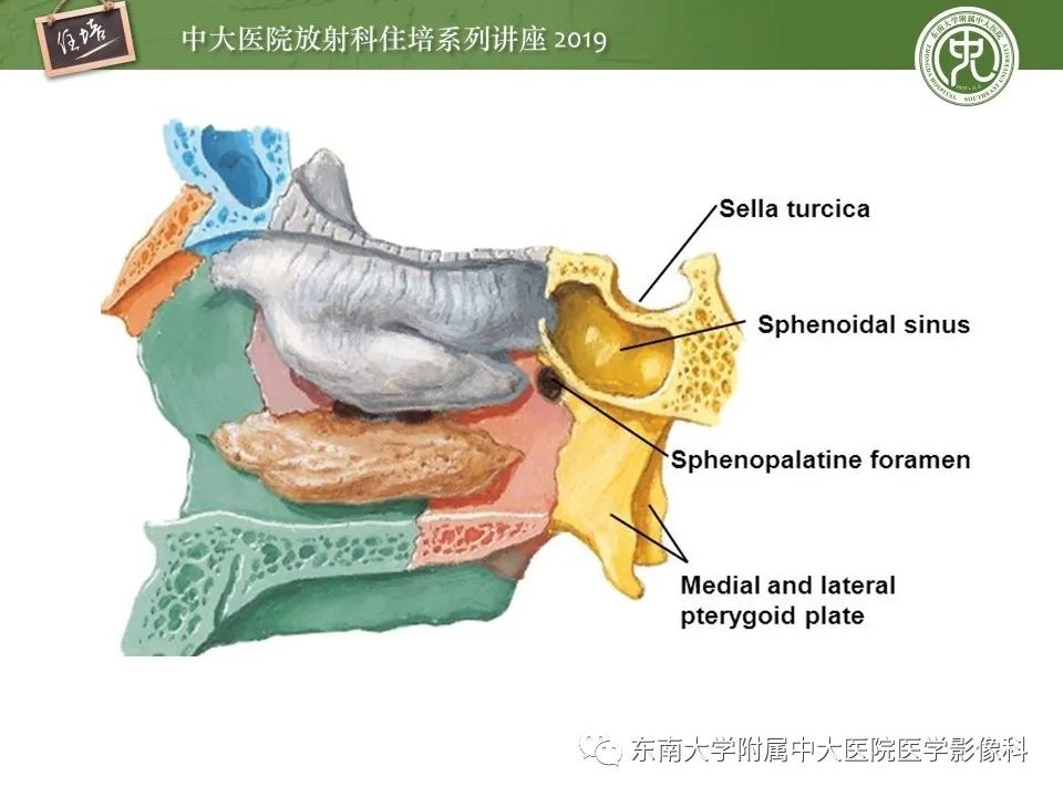 【PPT】翼腭窝的影像解剖及临床意义