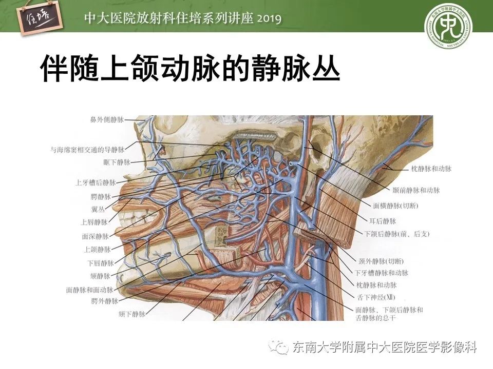 【PPT】翼腭窝的影像解剖及临床意义