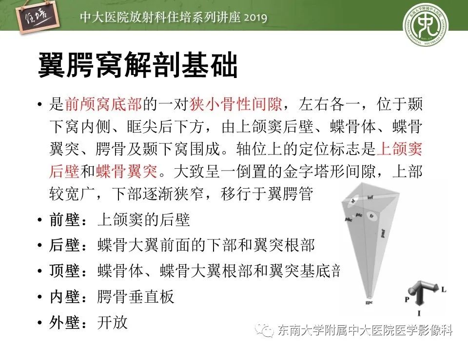 【PPT】翼腭窝的影像解剖及临床意义