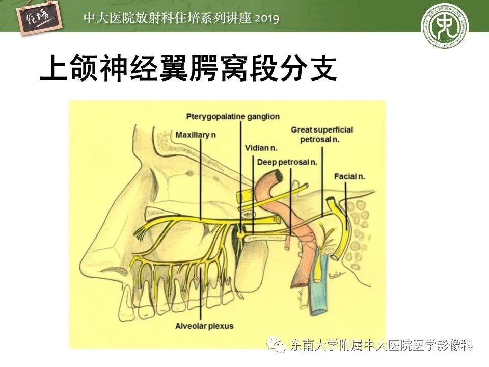 【PPT】翼腭窝的影像解剖及临床意义