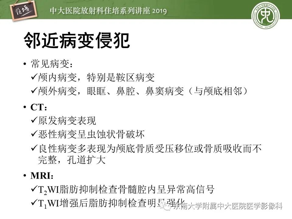 【PPT】翼腭窝的影像解剖及临床意义