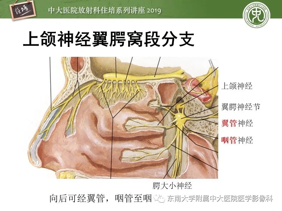 【PPT】翼腭窝的影像解剖及临床意义
