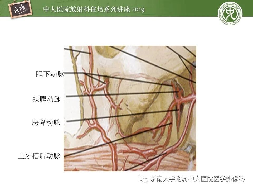 【PPT】翼腭窝的影像解剖及临床意义