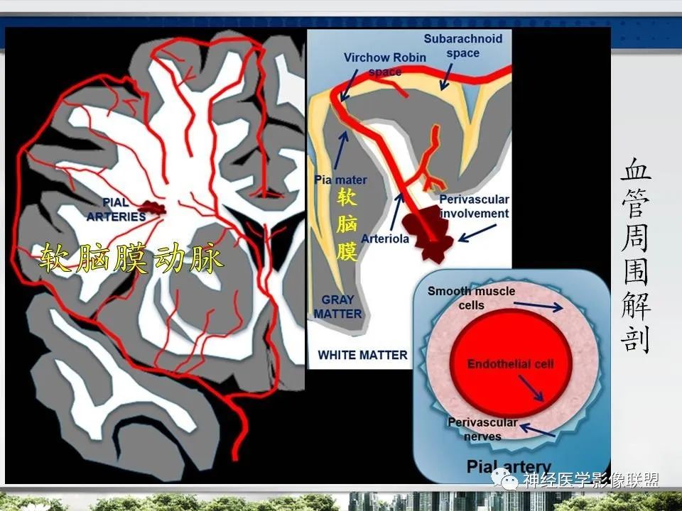 【PPT】血管周围间隙模式：血管与脑组织之间病变诊断