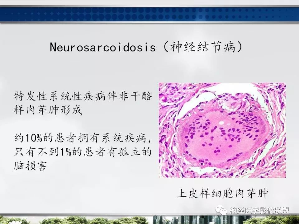 【PPT】血管周围间隙模式：血管与脑组织之间病变诊断