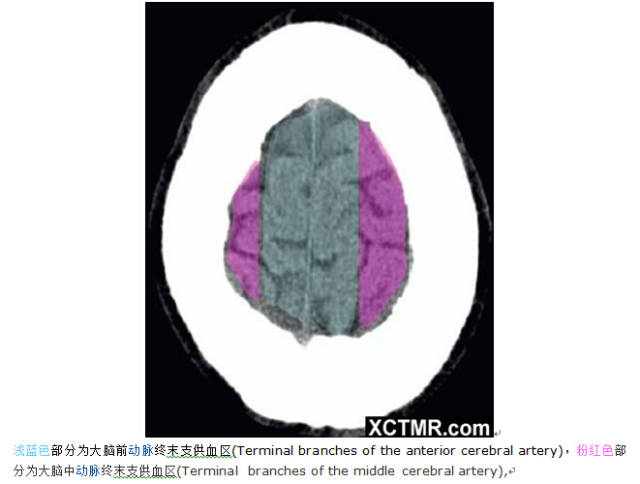 颅脑CT彩色解剖