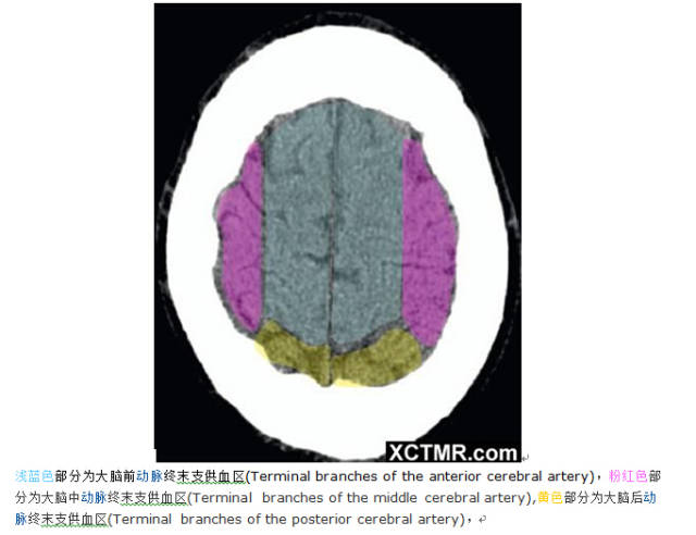 颅脑CT彩色解剖